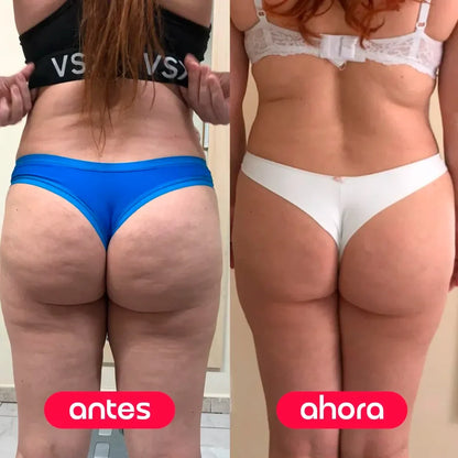 Candela — Crema Reductora de Estrías y Celulitis